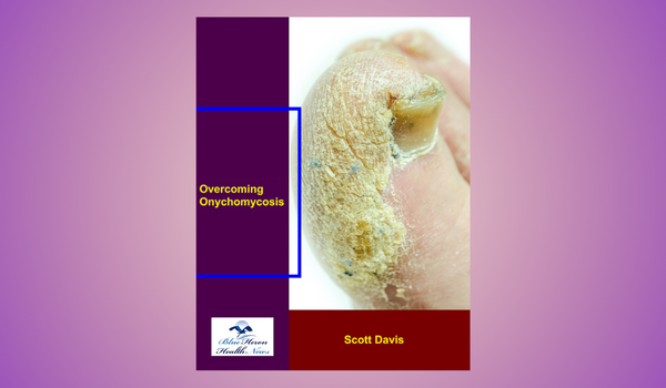 Overcoming Onychomycosis Reviews